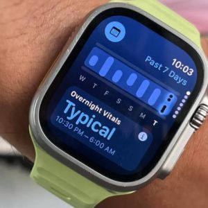 Fedezd fel a watchOS 11 legjobb funkcióit: Ez minden Apple Watch tulajdonos álma!