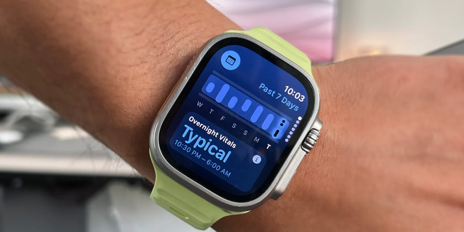 Fedezd fel a watchOS 11 legjobb funkcióit: Ez minden Apple Watch tulajdonos álma!